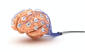 File:Brain w Electrodes.png